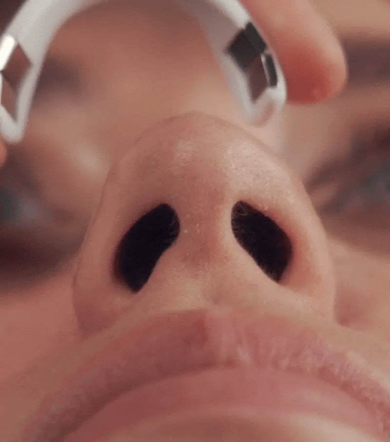 AirMag™ Magnetic Nasal Strips